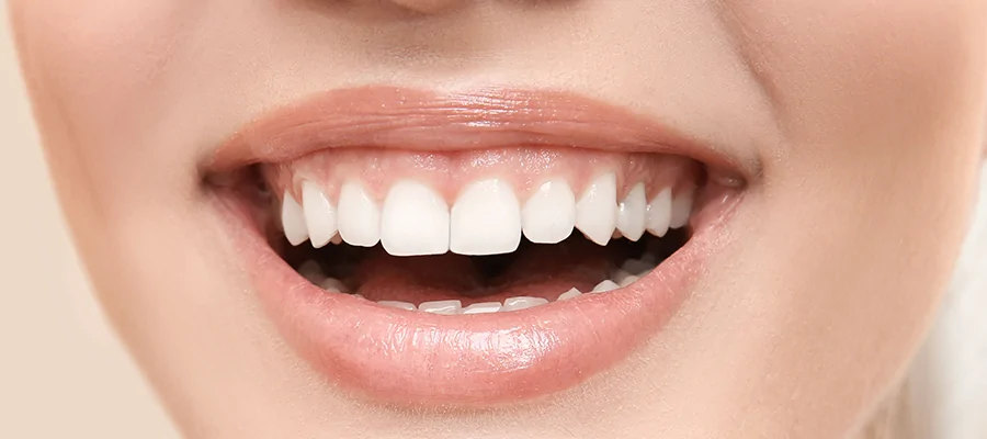 Gummy Smile Toksin Tedavisi